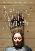 Poster My Beautiful Broken Brain