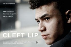 Poster Cleft Lip