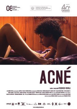 Poster Acné