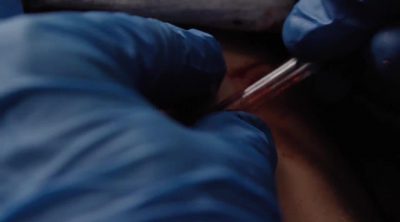 'The Good Doctor' Trailer